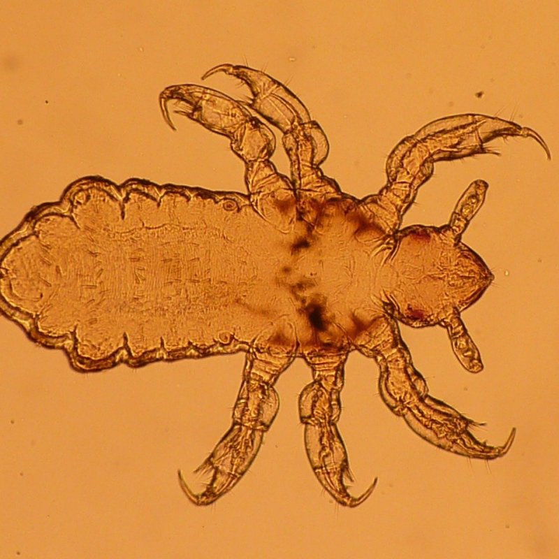 Dr. Detective: Delousing a&nbsp;Disease